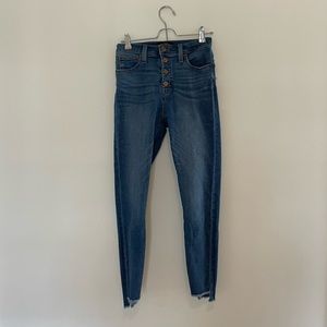 Button Up Skinny Jeans with Step Hem
